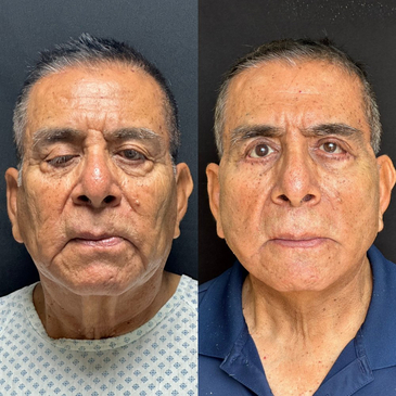 Slider image (7) Dr. Gabriel Sandoval - Plastic Surgeon in Mexico